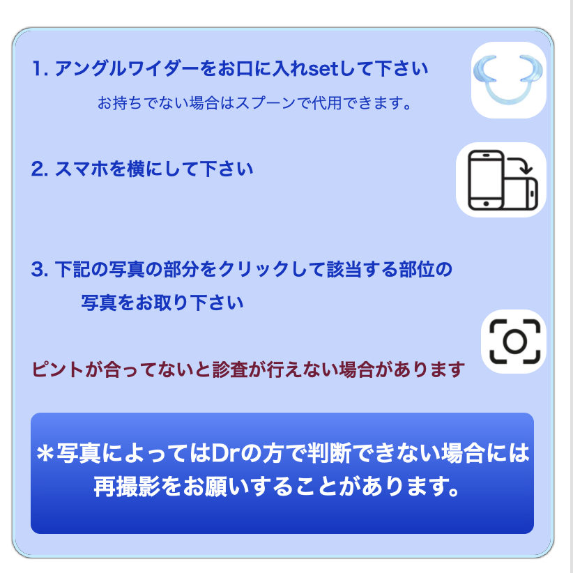 君津、袖ヶ浦、長浦、木更津、インビザライン,小児矯正、マウスピース矯正, デンタルモニタリング,非抜歯,